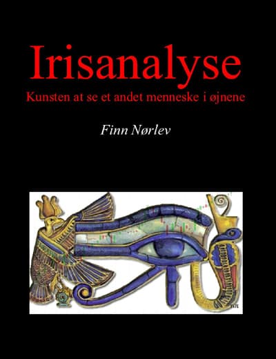 Irisanalyse